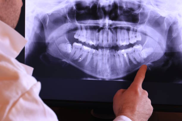 Best Emergency Root Canal Treatment in Bolivar, WV