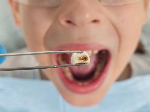 Best Emergency Treatment for Toothache in Bolivar, WV